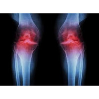 ARTHRITIS AYURVEDA KIT ARTHRITIS AYURVEDA KIT